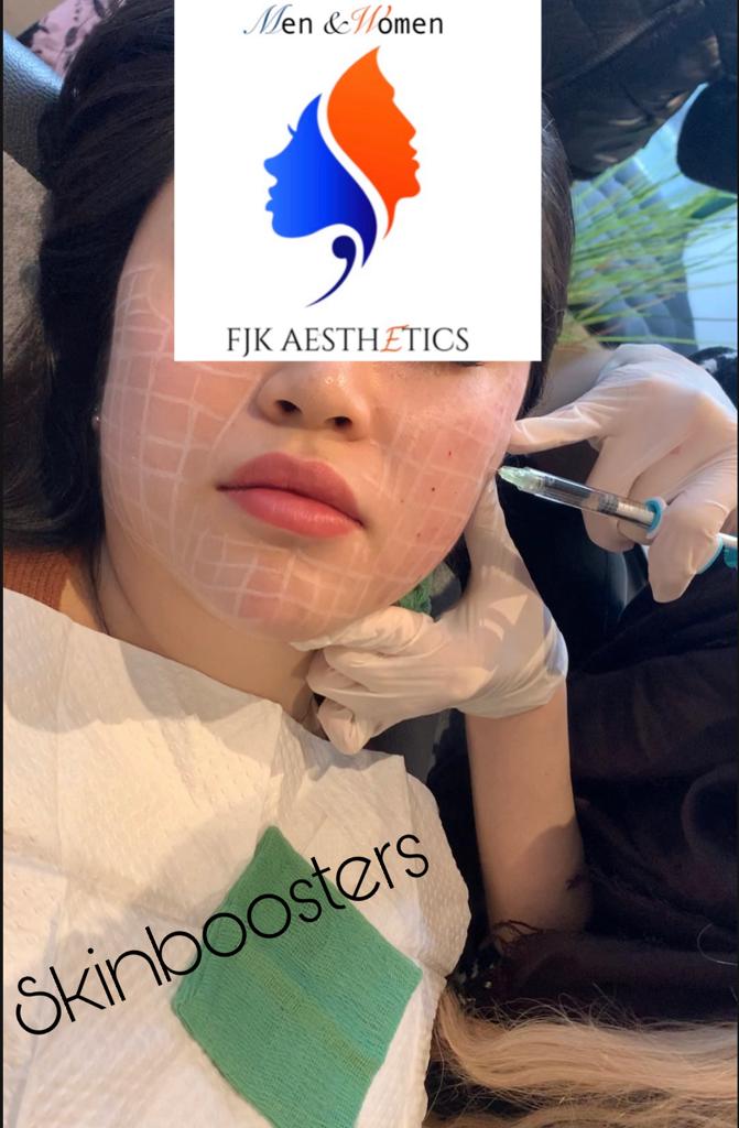 skinboosters2